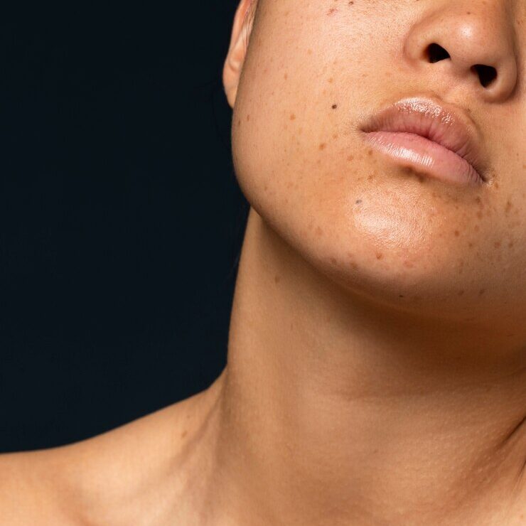 Original Where to Buy Skincare Products for Dark Spots, Uneven Skin Tone, and Hyperpigmentation in Lagos in Lagos Nigeria Buy the original Where to Buy Skincare Products for Dark Spots, Uneven Skin Tone, and Hyperpigmentation in Lagos in Lagos Nigeria