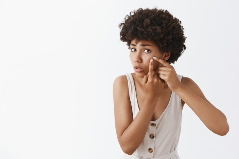 Buy the original The Best Pimple Patches in Lagos for Quick Acne Treatment in Lagos Nigeria